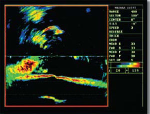 Sonar per barca - SS395 Series - Wesmar